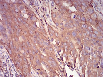 SERPINA1 Mouse mAb[64221]