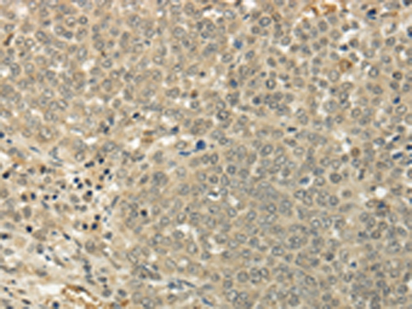 SIAH1 Antibody[43329]
