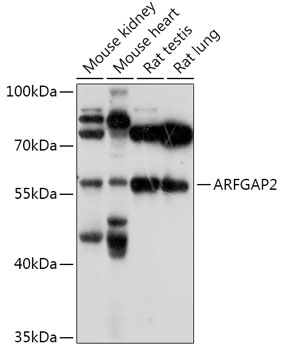 ARFGAP2 Rabbit Polyclonal Anti