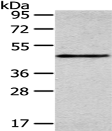SMYD2 Antibody[43434]