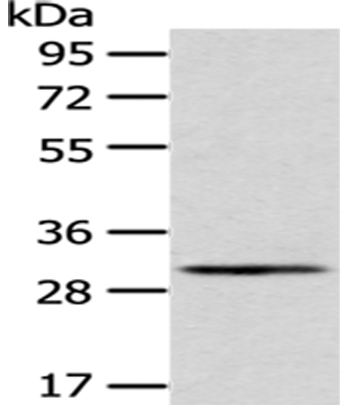 AQP3 Antibody[43394]