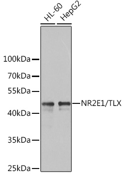 NR2E1 Rabbit Polyclonal Antibo