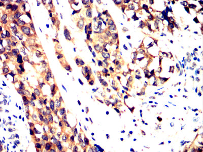 PPID Mouse mAb[64112]