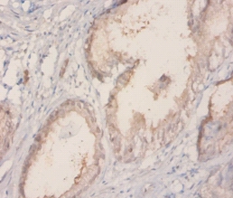 60 kDa SS-A/Ro ribonucleoprote