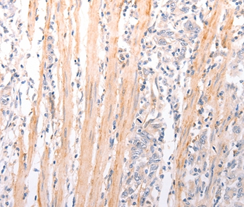 ABCA2 Antibody[37304]