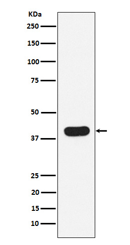 HLA B7 Rabbit mAb[56703]