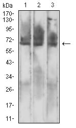 MSLN Mouse mAb[63954]