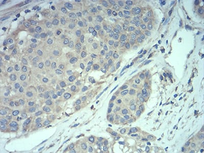 MECP2 Mouse mAb[63923]