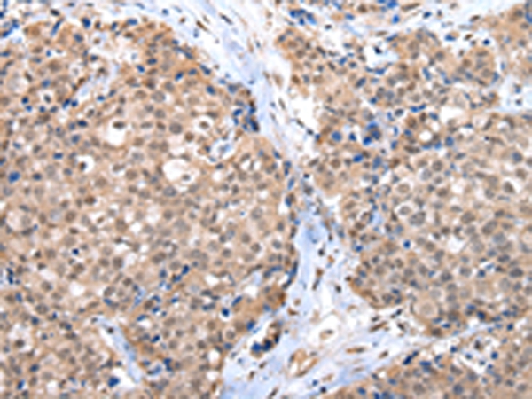 CTBP1 Antibody[43242]