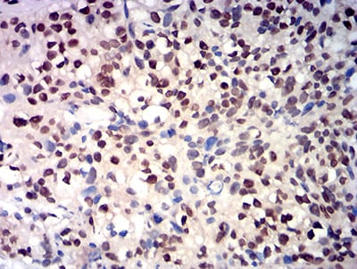 RBBP7 Mouse mAb[64174]