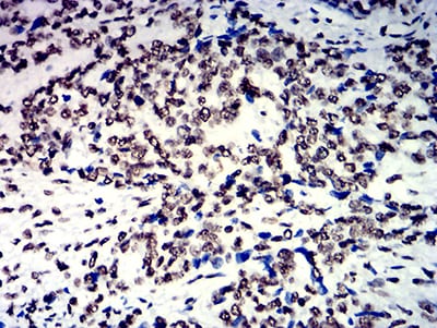 NAGR1 Mouse mAb[63981]