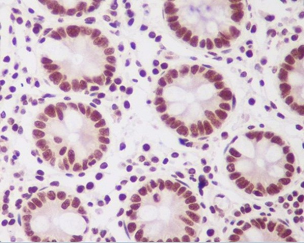 PTBP2 Rabbit mAb[56010]