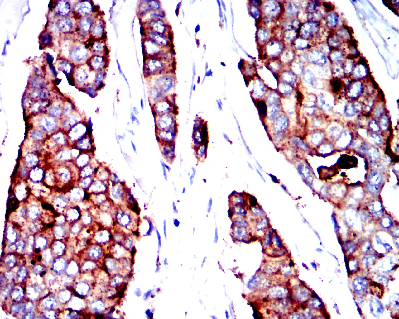 CEACAM5 Mouse mAb[63458]