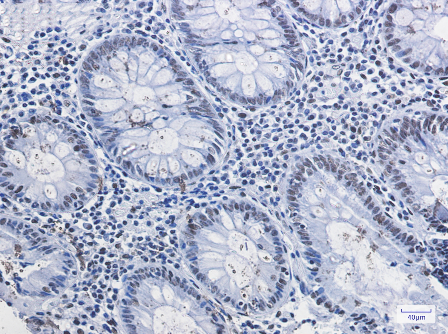 HDAC2 Rabbit mAb[52328]