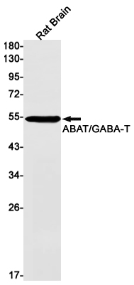 ABAT Rabbit mAb[52114]