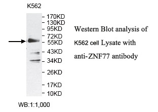 ZNF77 Antibody[39797]