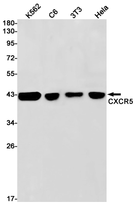 CXCR5 Rabbit mAb[52234]