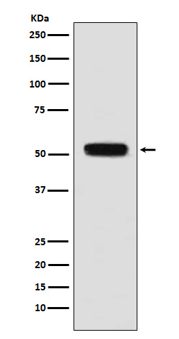 Fibulin 5 Rabbit mAb[56191]