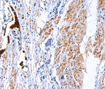 CATSPER1 Antibody[36313]