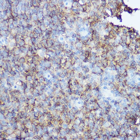 MS4A1 antibody[38300]