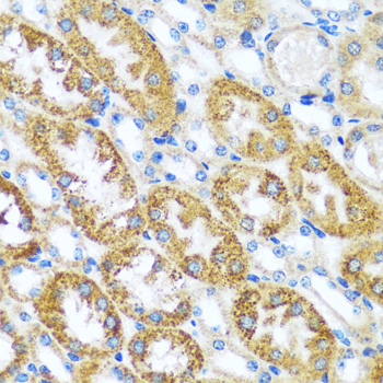 CAST Rabbit Polyclonal Antibod