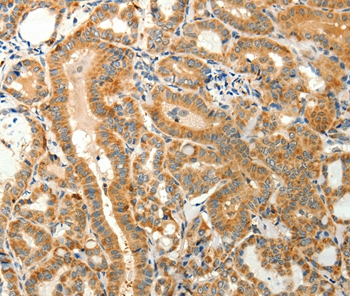 TMSB4X Antibody[37278]