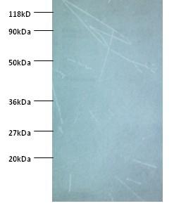 NADH dehydrogenase [ubiquinone
