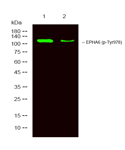 EPHA6 (Phospho-Tyr977) Antibod
