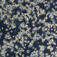 浙江(杭州)美森 人肺腺癌细胞PC-9(Luc1)现货