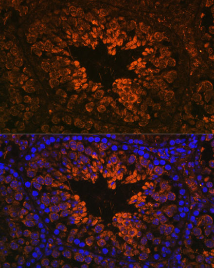 RTN4 Rabbit Polyclonal Antibod
