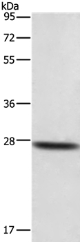 DKK2 Antibody[35714]