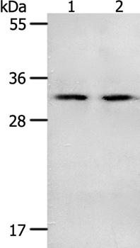 NME6 Antibody[35841]