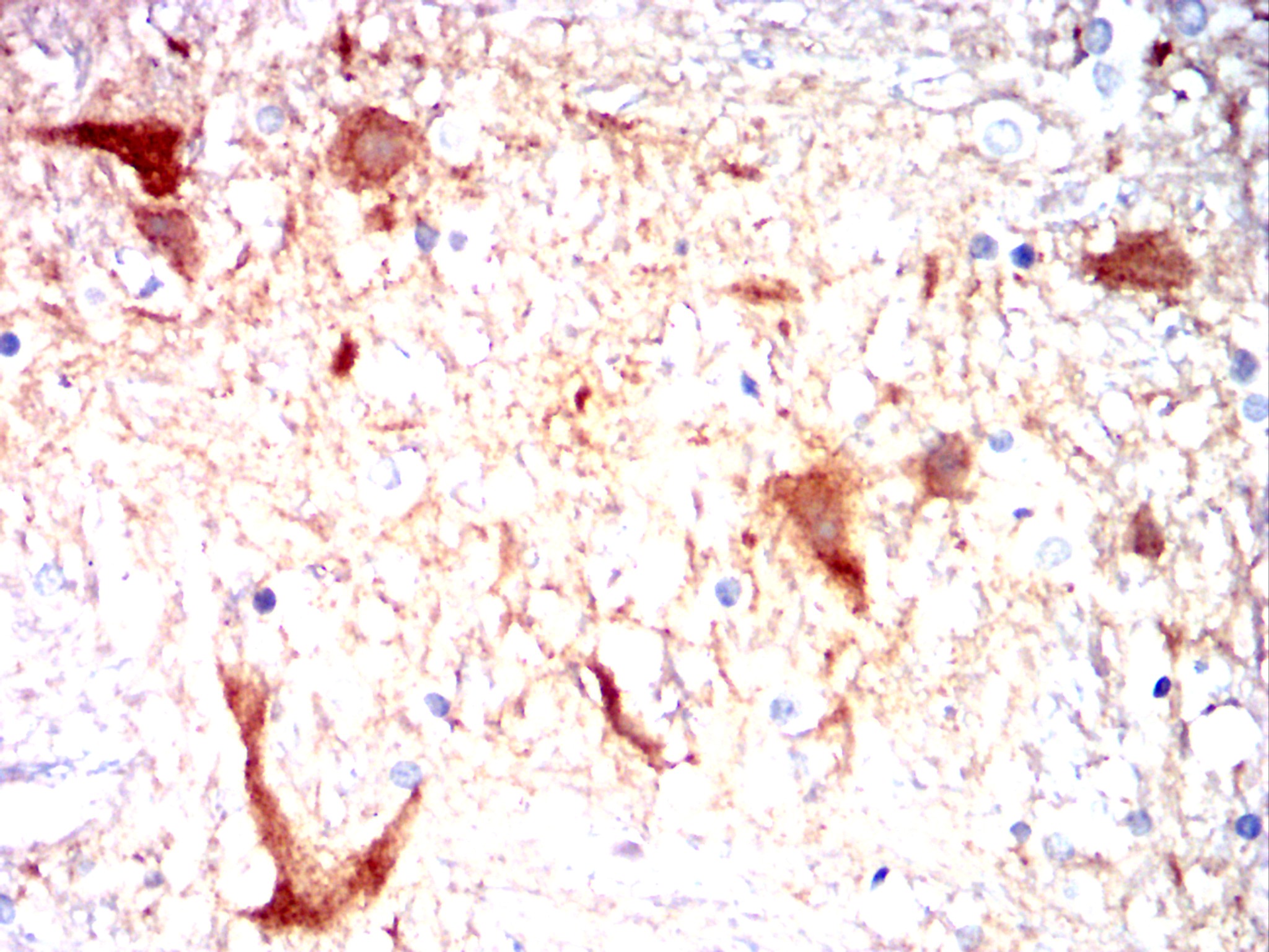 CAMK2G Mouse mAb[63190]