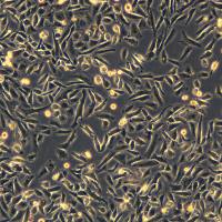 浙江（杭州）美森 人肺腺鳞癌细胞NCI-H1703（Luc2）现货