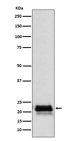 FSH beta(FSHB) Rabbit mAb[5639