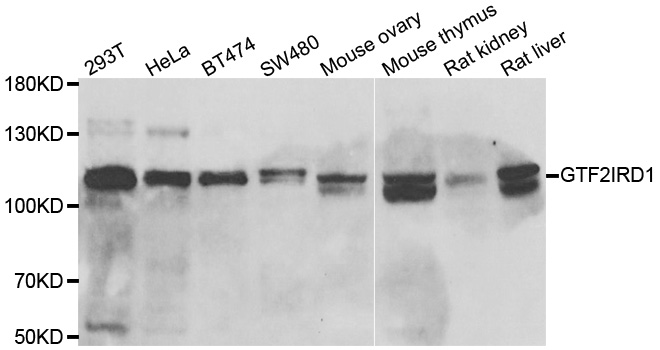 GTF2IRD1 antibody[39045]