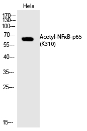 NFκB-p65 (Acetyl-Lys310) Polyc