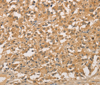 NFE2L1 Antibody[35844]