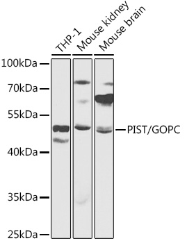 GOPC Rabbit Polyclonal Antibod