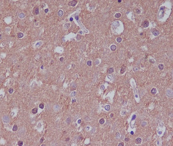 Substance P Rabbit mAb[56143]