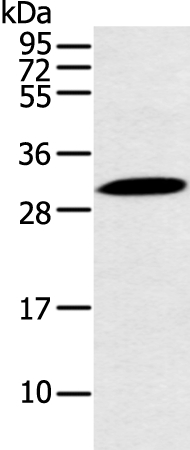 YRDC Antibody[43223]