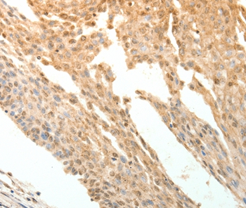 PTPRE Antibody[35900]