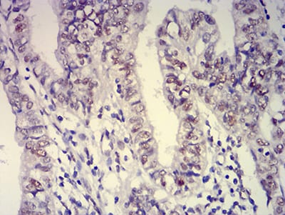 ATXN1 Mouse mAb[63121]