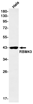RBM43 Rabbit mAb[52678]