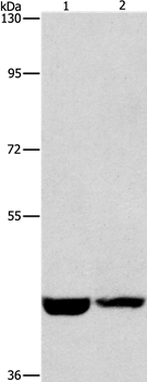 CSNK1E Antibody[36232]