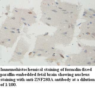 ZNF280A Antibody[39634]