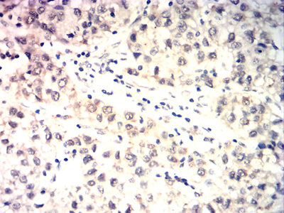TDP43 Mouse mAb[64305]