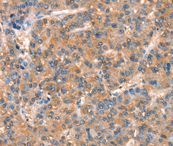 ARHGAP4 Antibody[37353]