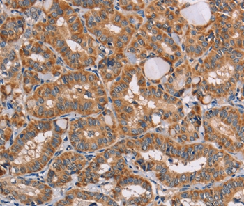 AAAS Antibody[36054]