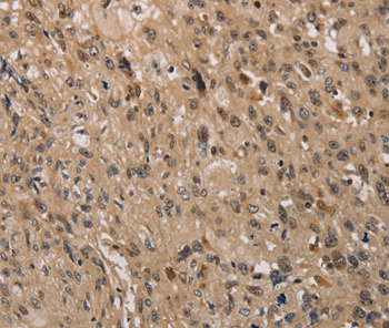 KDM4A Antibody[37671]